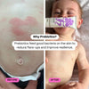Before and after comparison of a child's skin with a tube of cream labelled 'Noody Calm Balm'.