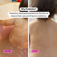 Before and after comparison of skin with text about prebiotics on a bathroom background.