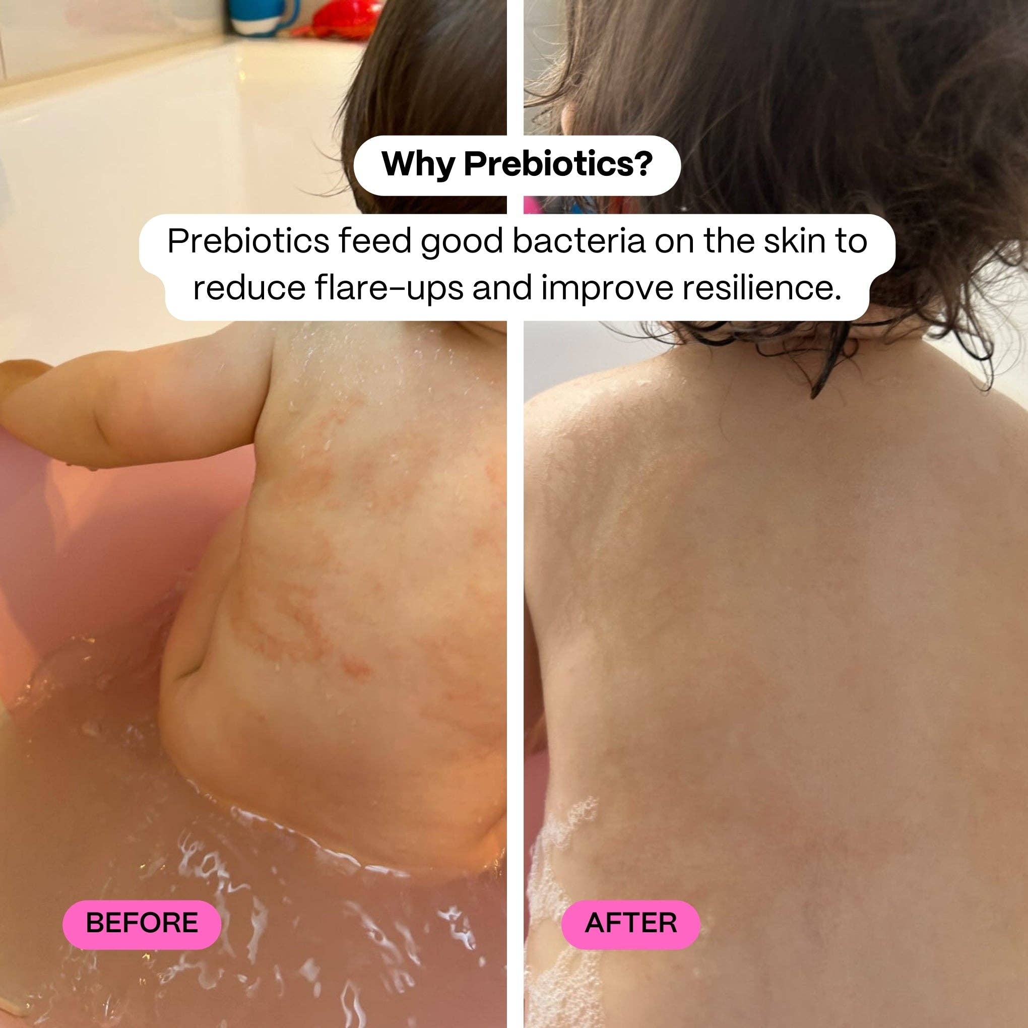 Before and after comparison of skin with text about prebiotics on a bathroom background.