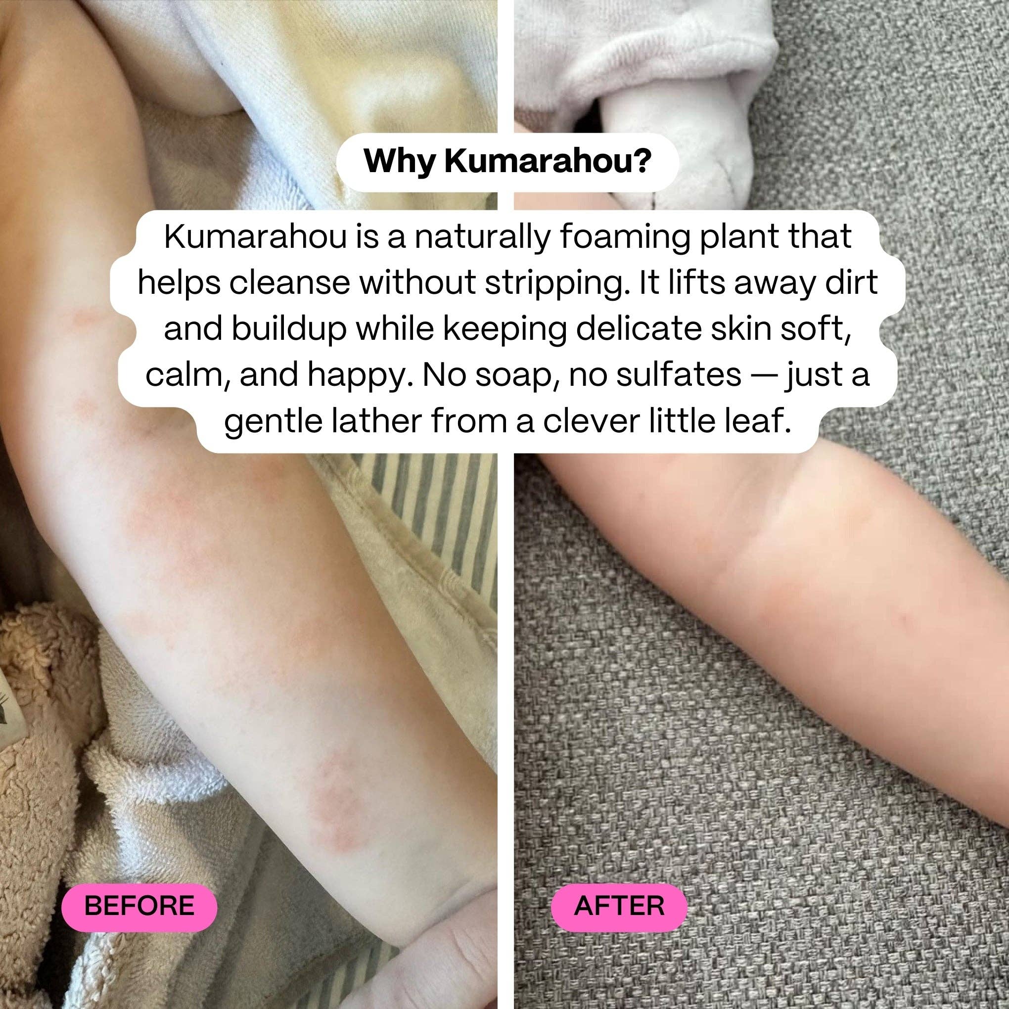 Before and after comparison of a child's skin with Kumarahou, a naturally foaming plant cleanser.